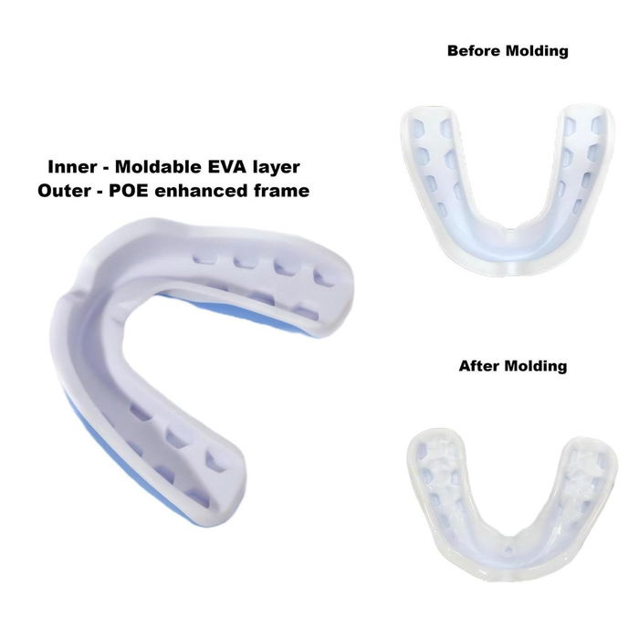 Ergo Fit Fusion Mouthguard