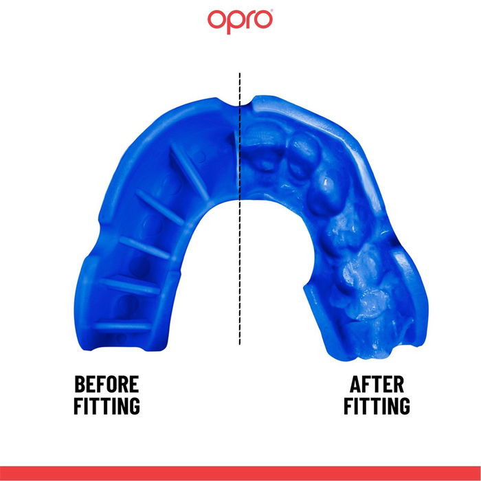 Self Fit Mouthguard Adults